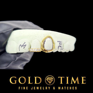 Yellow gold open face caps fitted to a dental mold on a black background