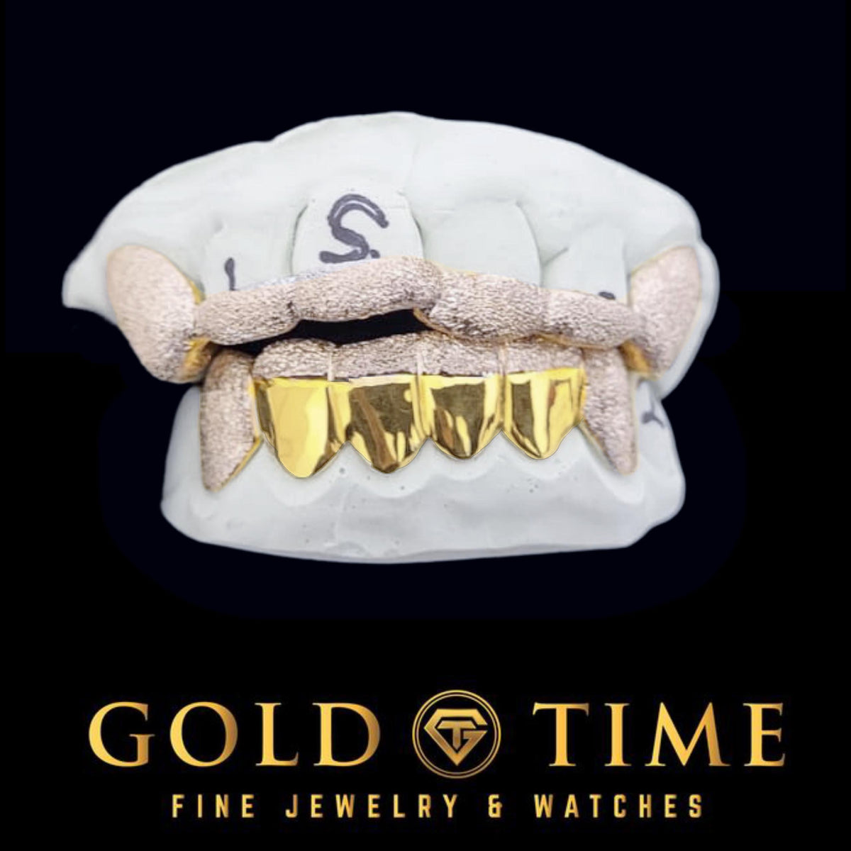 Custom 12 Piece Two-Tone Grillz Set  Yellow and White Diamond Dust, Top & Bottom Grill, Made to Order with Impression Kit