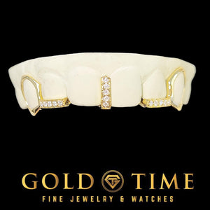 Front view of the 5 piece grillz set on a dental model with the moissanite gap bar centered