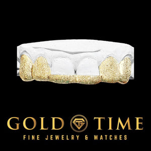 Six piece yellow gold diamond dust tip grill shown on a dental mold
