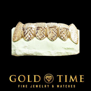 Yellow gold 6 piece trillion cut grillz with diamond dust caps and pointed canine fangs on a dental model