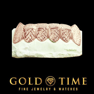 Rose gold 6 piece trillion cut grillz with diamond dust caps and canine fangs on a dental model