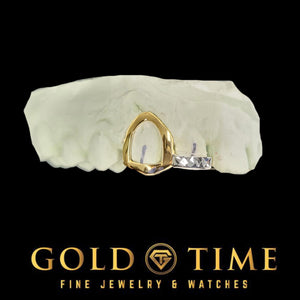 Custom two-tone double cap grillz with white trillion tip and yellow gold open face
