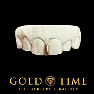Rose gold single gap bar grill between the front teeth on a white mold