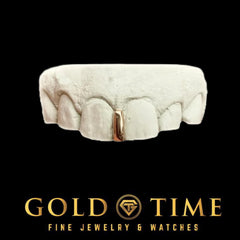 Custom Single Gap Grillz: Gold or Silver Tooth Bar with Mold Kit