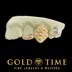 Custom 4-Piece Gold Grillz with Diamond-Cut Fangs and Trillion Dust - Handmade Personalized Grill - Solid Gold & Silver Options