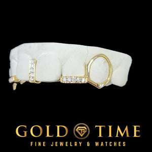 Side view of the gold 5 piece grillz showing the open face canine fang outline