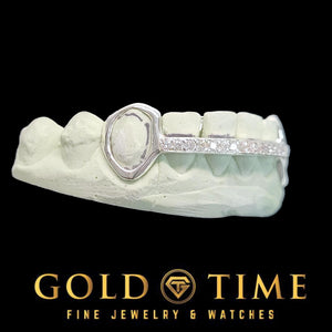 Side view of the white gold open face grillz showing the moissanite center bar