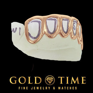 Close-up of rose gold open face grillz on a dental mold showing the thin polished outline