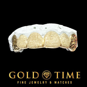 Yellow gold 6 piece grillz with diamond dust fronts and faceted trillion cut canines on a dental model, Gold Time