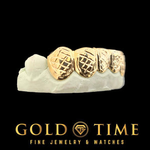 Yellow gold box trillion grillz on a cream dental model, angled view