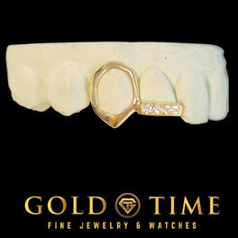Yellow gold double cap grillz with an open face fang cap on the canine and a moissanite tip bar on the next incisor
