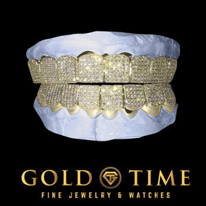 Iced out CZ block grillz top and bottom sets in yellow gold tone fitted on a dental model