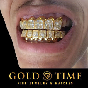 Yellow CZ block grillz worn in the mouth, top set, showing how the stones sit across the teeth