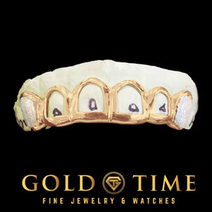 Yellow gold open face grillz with dusted canines seated on a cream dental model