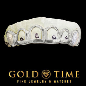 White gold six tooth open face grillz with diamond dust canines on a dental model