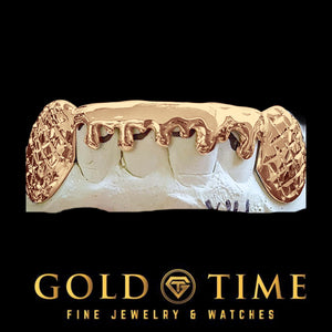 Rose gold 6 piece bottom grillz with trillion cut canines and drip design on a dental mold