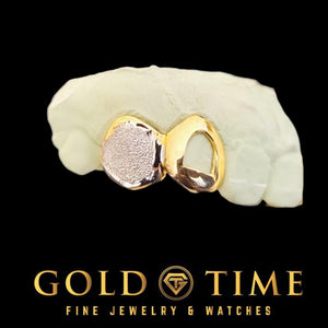 Two-tone gold double cap grill with a diamond dust box canine and an open face incisor on a dental mold, Gold Time