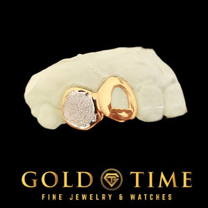 Rose gold double cap grill with a diamond dust box canine and an open face incisor on a dental mold