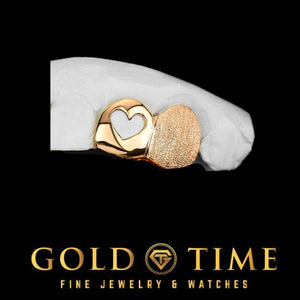 Rose gold double cap grill with an open heart cutout and a diamond dust cap on a dental mold