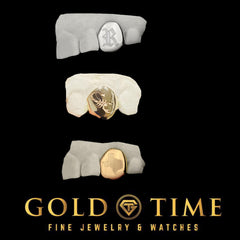 Custom Single Cap Grill with Engraving - Personalized Tooth Cap - Handmade Gold, Silver, Rose Gold Grillz - Includes Impression Kit