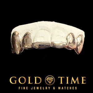 Rose gold six piece solid grillz with canine fangs seated on a dental model