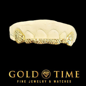 Custom 6 piece yellow gold trillion cut grillz with solid canines and front tips