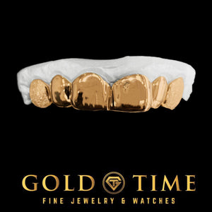 Rose gold 6 piece grillz with solid fronts and diamond dust canines fitted to a dental mold