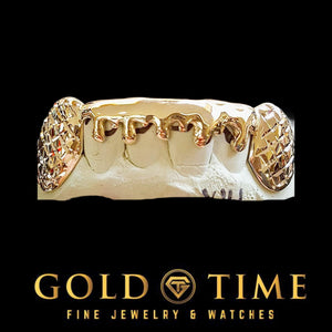 Yellow gold 6 piece bottom grillz with trillion cut canines and a drip cut lower edge