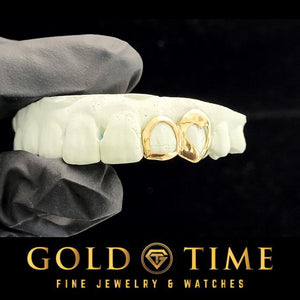 Angled view of the two gold heart cut out caps on a dental mold