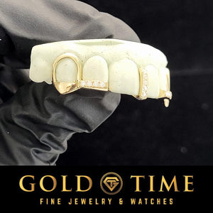 Gold 5 piece open face grillz shown on the upper teeth of a dental model held in a gloved hand