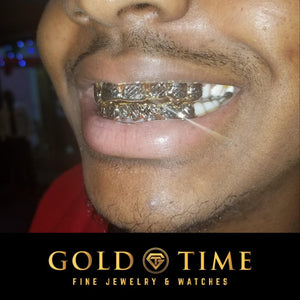 Two tone trillion cut box grillz worn, showing the cut pattern catching light