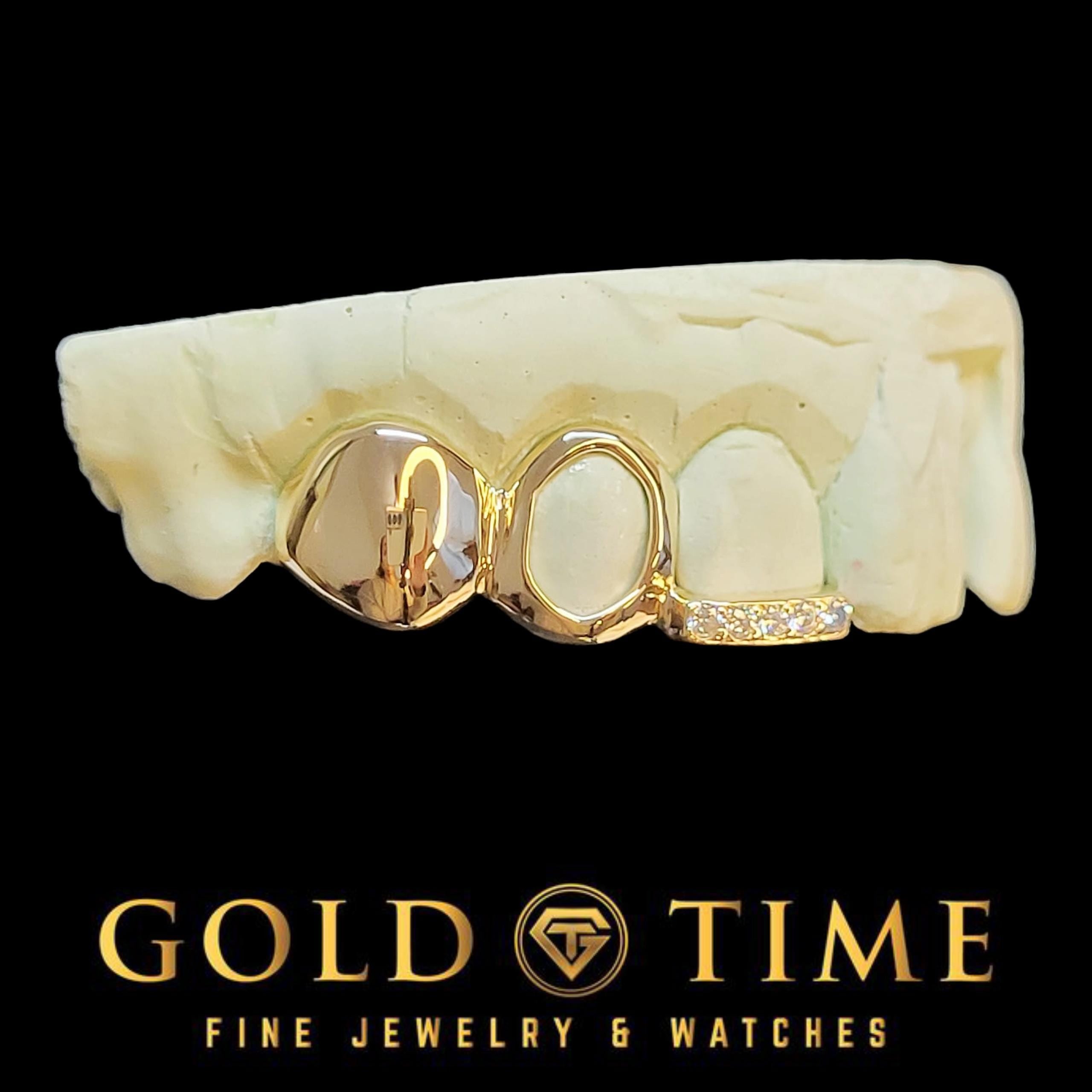 Custom 3-Piece Grillz Set: Solid, Open Face, Moissanite Tip - Includes Mold Kit