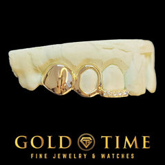 Custom 3-Piece Grillz Set: Solid, Open Face, Moissanite Tip - Includes Mold Kit