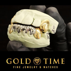 Side view of two-tone 8 piece grillz with yellow canines and white drip bottom on a mold