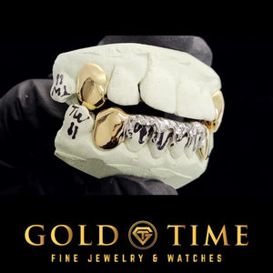 Angled view of two-tone 8 piece grillz with trillion drip bottom on a dental mold