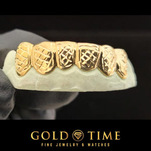 Six piece yellow gold grillz with a trillion cut box pattern on a dental mold