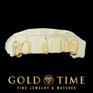 Yellow gold open face incisors, solid canines and gap bar on a mold