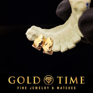 CZ block double cap grillz in rose plated silver on a dental mold held in a gloved hand, viewed from above