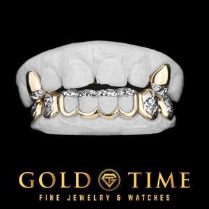 Custom 10 piece two-tone gold grillz with trillion cut top canines and open window bottom row on dental molds