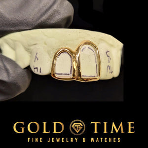 Yellow gold open face double cap grillz on a marked dental mold held in a gloved hand, Gold Time
