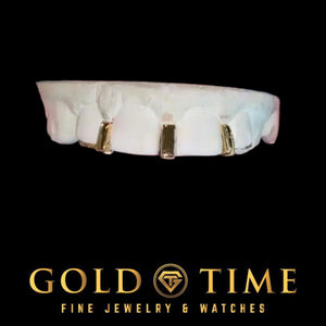 Custom yellow gold 3 gap bar grillz on top teeth
