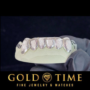 Silver 6 piece diamond dust box grillz with perm cuts shown fitted to a dental mold