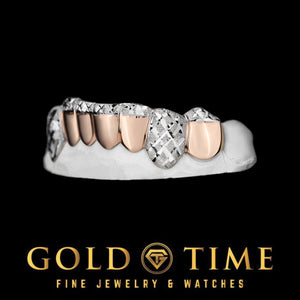 8 piece two-tone grillz with polished caps, white trillion diamond-cut tips, and diamond-cut canines on a mold
