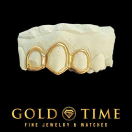 Yellow gold open face triple cap grillz on a dental mold, black background, Gold Time