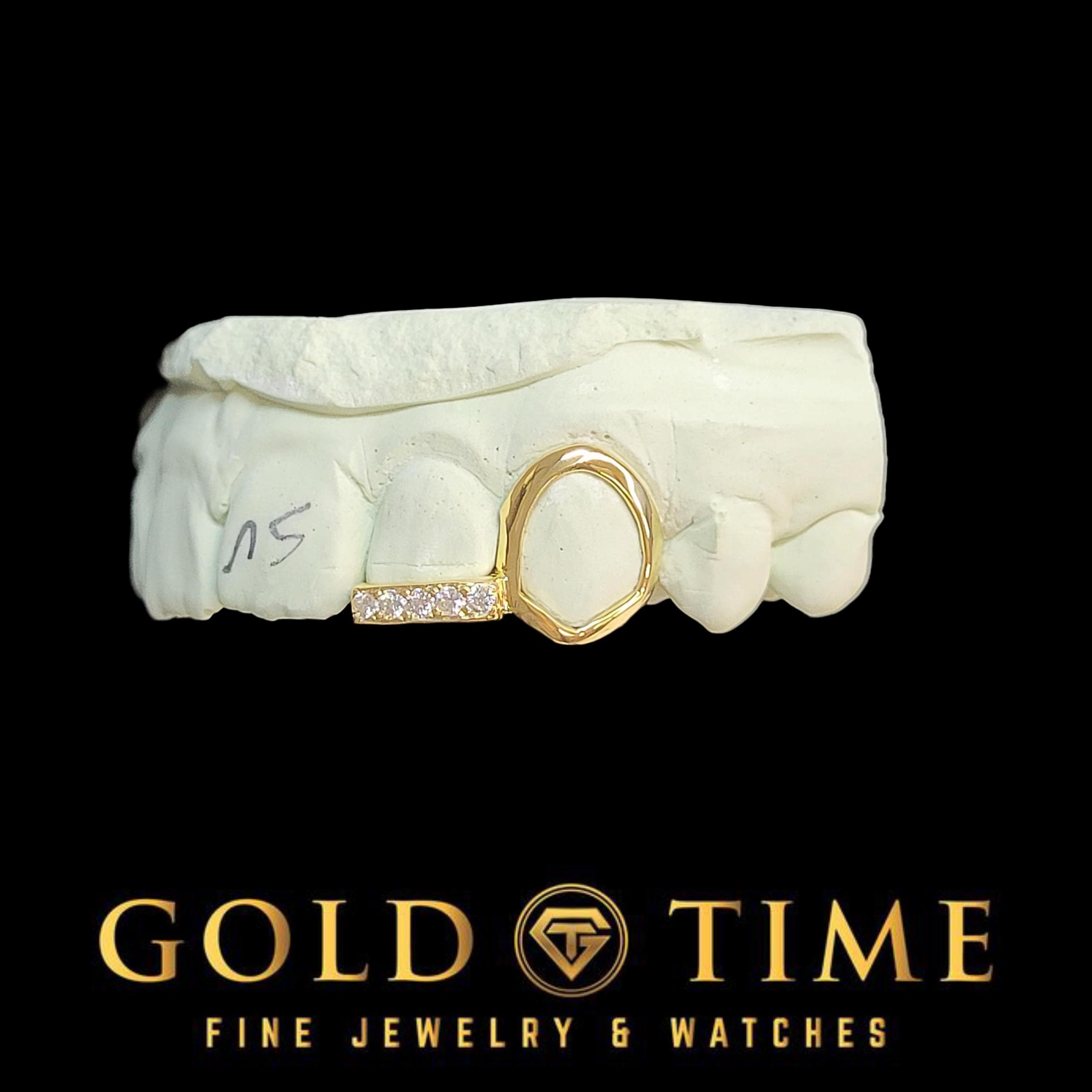 Custom Grillz: Open Face Canine & Moissanite Tip - Handmade Fit, Impression Kit