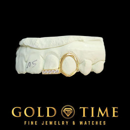 Yellow gold open face canine cap with an iced moissanite tip on the neighboring tooth, on a dental mold