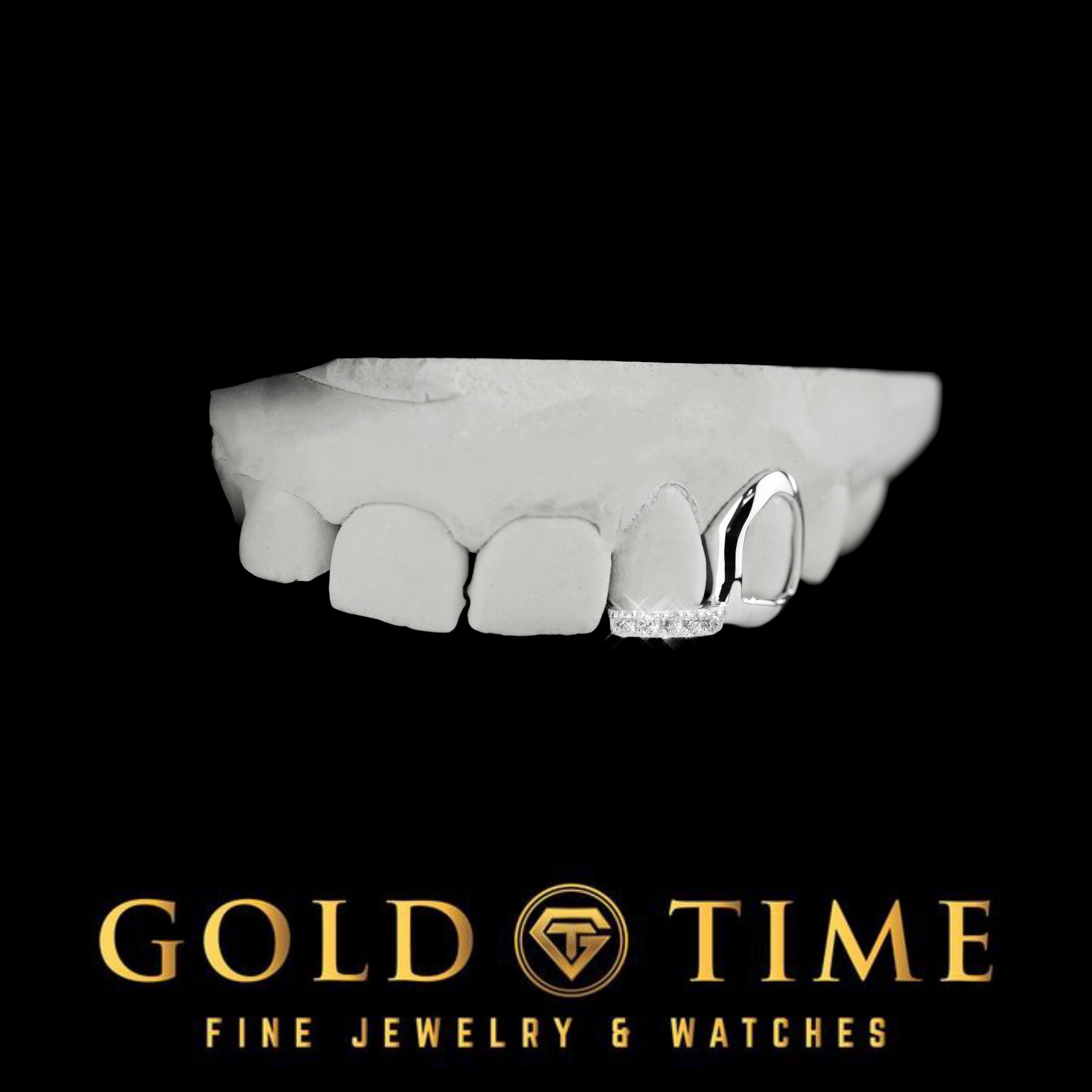 Custom Grillz: Open Face Canine & Moissanite Tip - Handmade Fit, Impression Kit