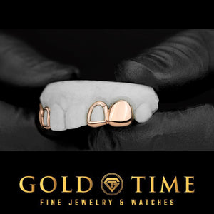 Rose gold open face and solid cap grillz on a dental mold held in gloved hands, angled view, Gold Time