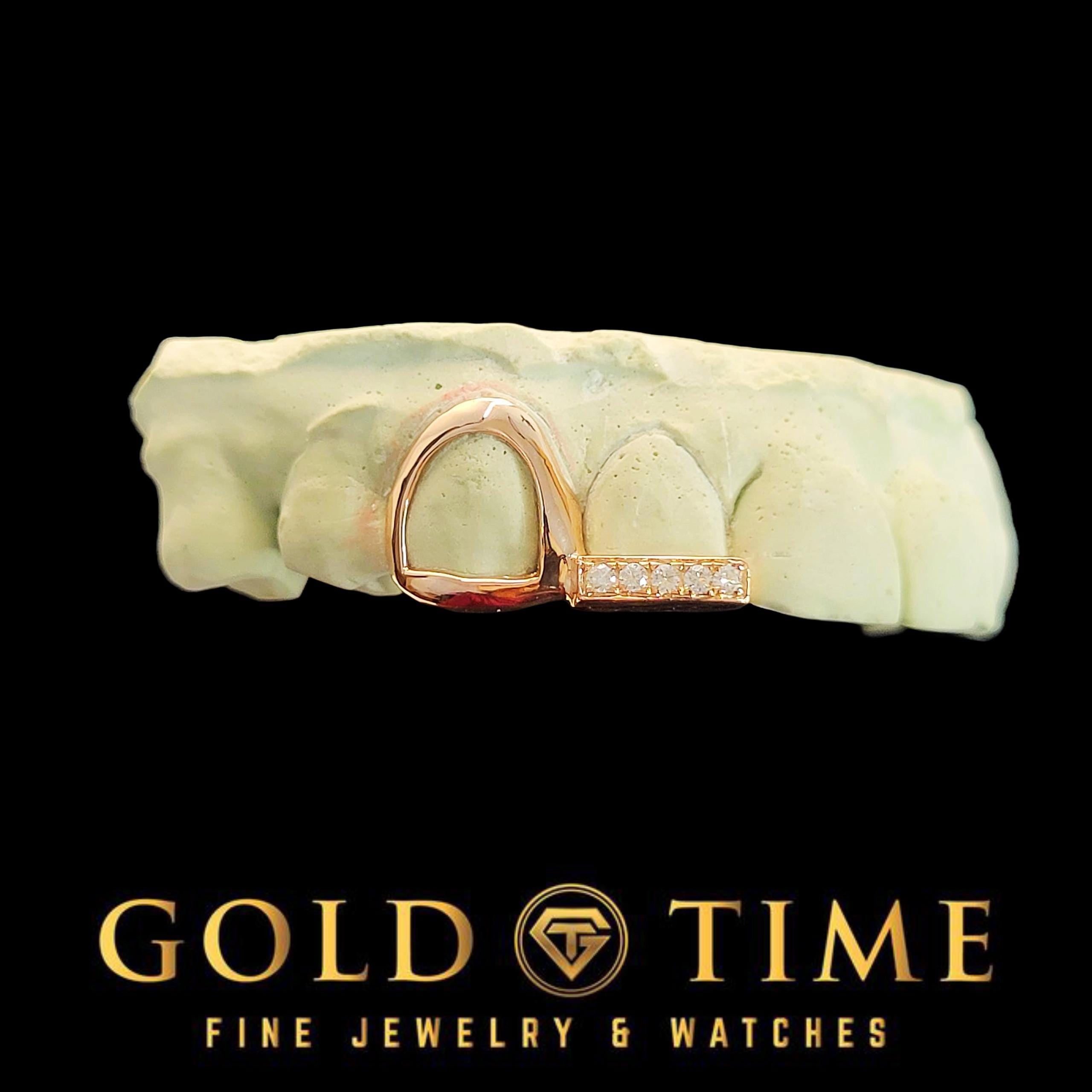 Custom Grillz: Open Face Canine & Moissanite Tip - Handmade Fit, Impression Kit